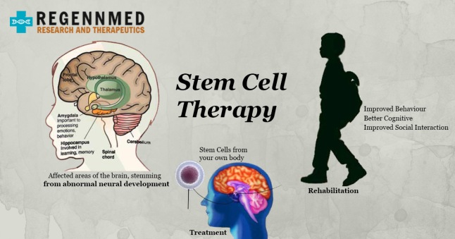 Stem Cells Therapy in Delhi
